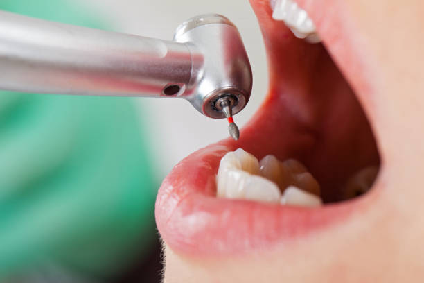 Best Urgent Tooth Repair  in Coleraine, MN